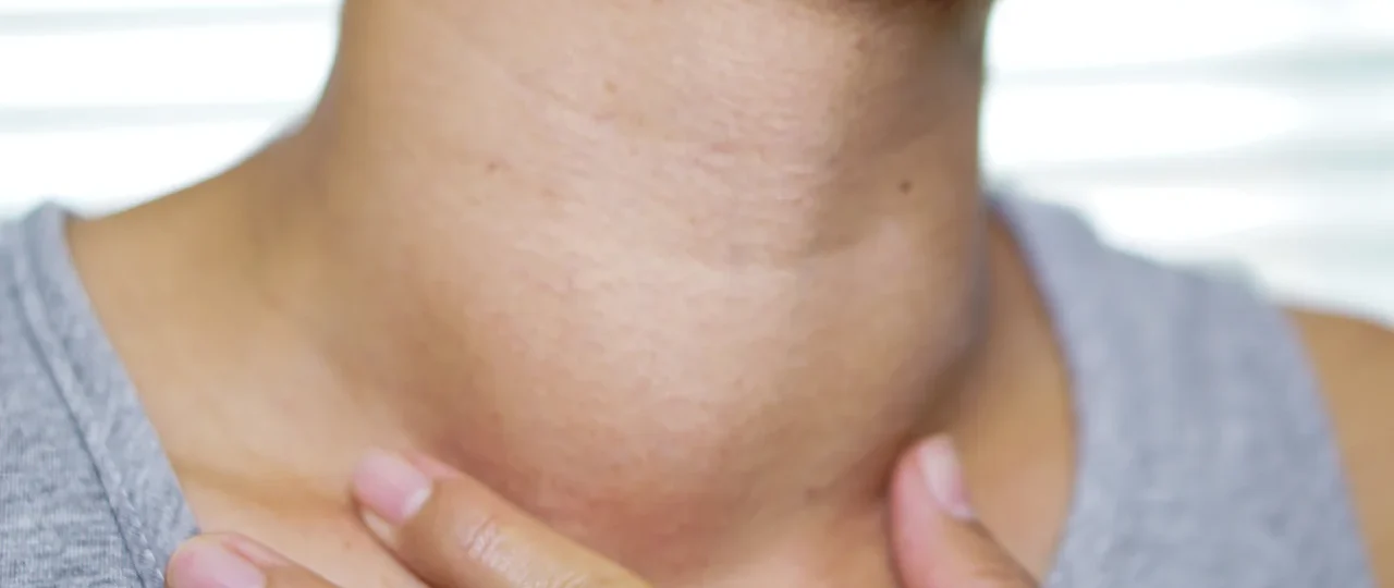 के तपाईलाई पनि यस्तो समस्या छ ? होशियार