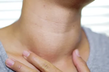 के तपाईलाई पनि यस्तो समस्या छ ? होशियार